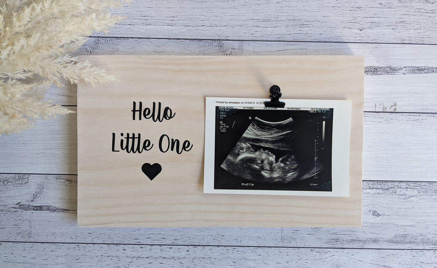 Pregnancy Announcement Photo Plaque | Wooden Photo Board Baby Ultra Sound